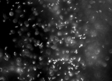 Spirilium bakterie. Foto: adonofrio, Creative Commons by 2.0